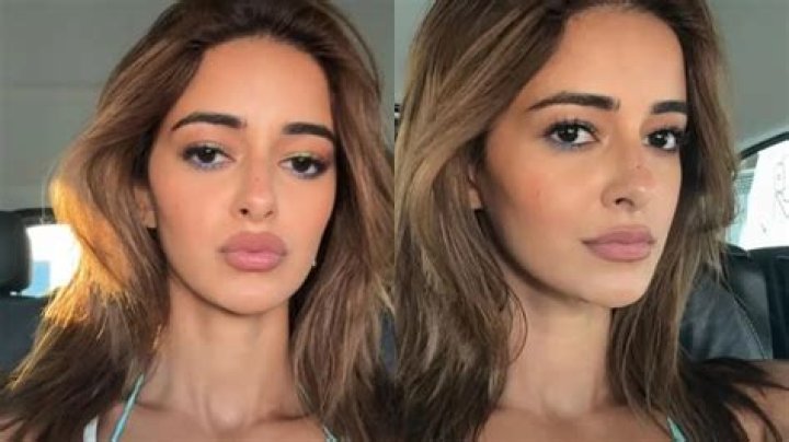 Alanna Panday: See Her Transformation Before Surgery