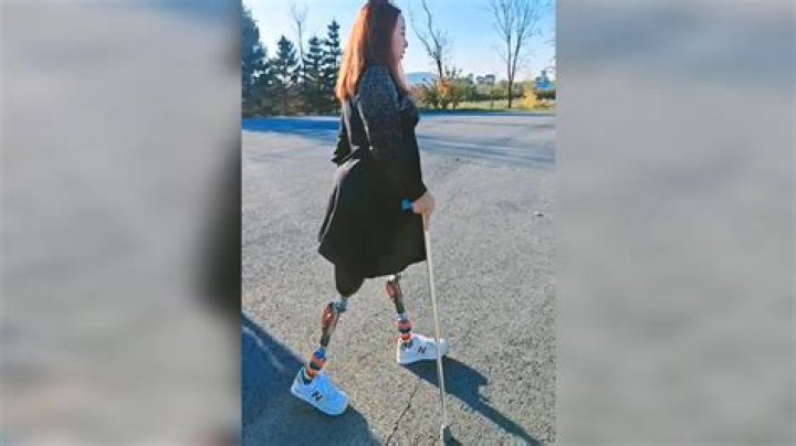 Inspiring Journeys: The Life Of Amputee Dak