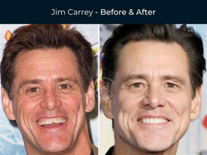 Transformations: Andrea Canning's Teeth Before And After