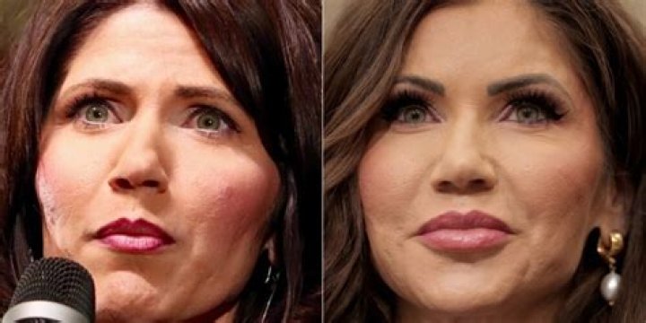 Uncovering The Truth: Governor Kristi Noem's Cosmetic Surgery Rumors