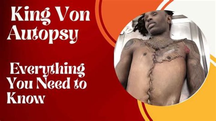 Unraveling The Mystery: King Von Cause Of Death Autopsy