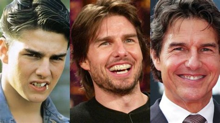 Unveiling The Charm: The Fascinating Story Of Teeth Tom Cruise