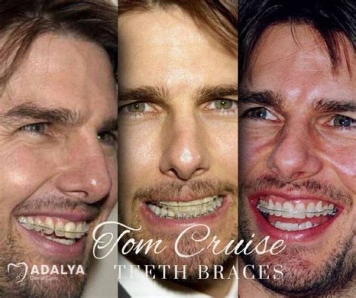 Unveiling The Mystery Of Middle Tooth Tom Cruise