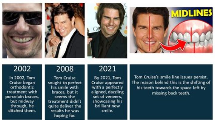 Unveiling The Mystery Of Tom Cruise's Tooth In The Middle